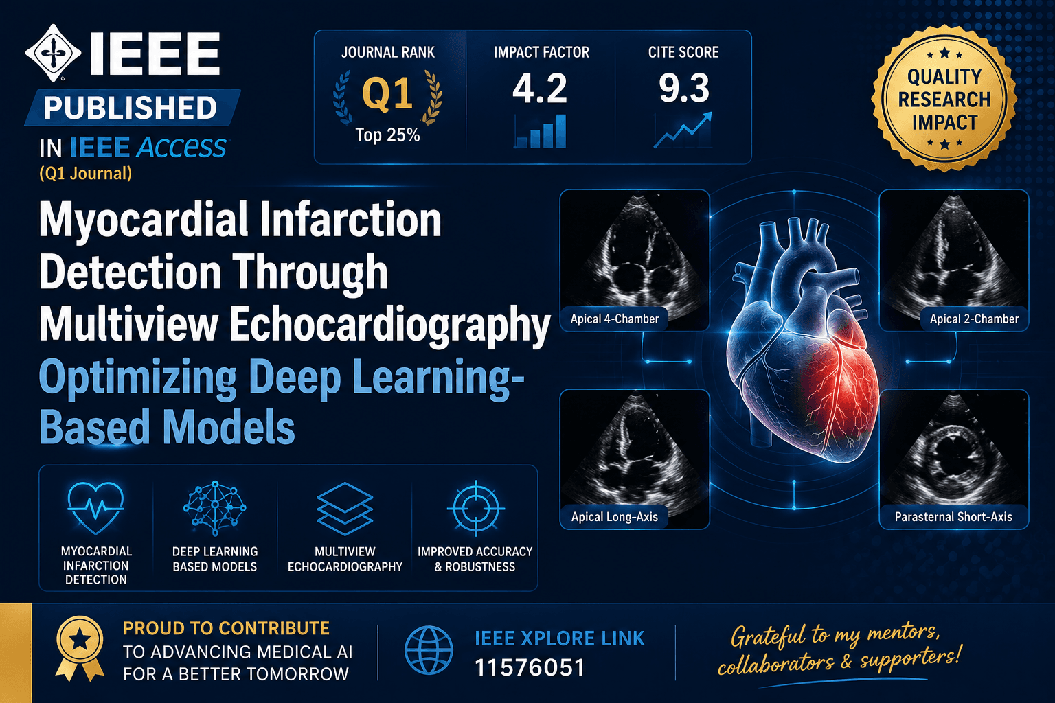 Myocardial Infarction Detection Through Multiview Echocardiography Optimizing Deep Learning-Based Models
